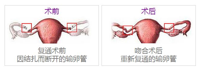 重慶送子鳥醫(yī)院