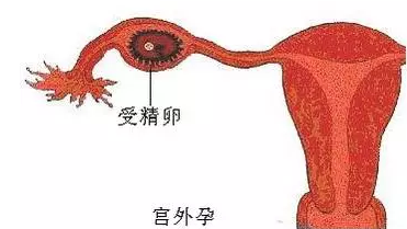 重慶送子鳥醫(yī)院