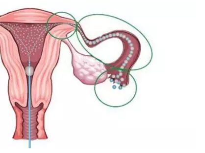 重慶送子鳥(niǎo)醫(yī)院