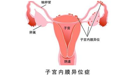 重慶送子鳥(niǎo)醫(yī)院