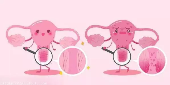 重慶送子鳥醫院,粘連